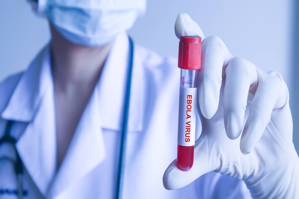 காங்கோ: எபோலாவால் (Ebola Virus) பலி எண்ணிக்கை 2 ஆயிரத்தைத் தாண்டியது!